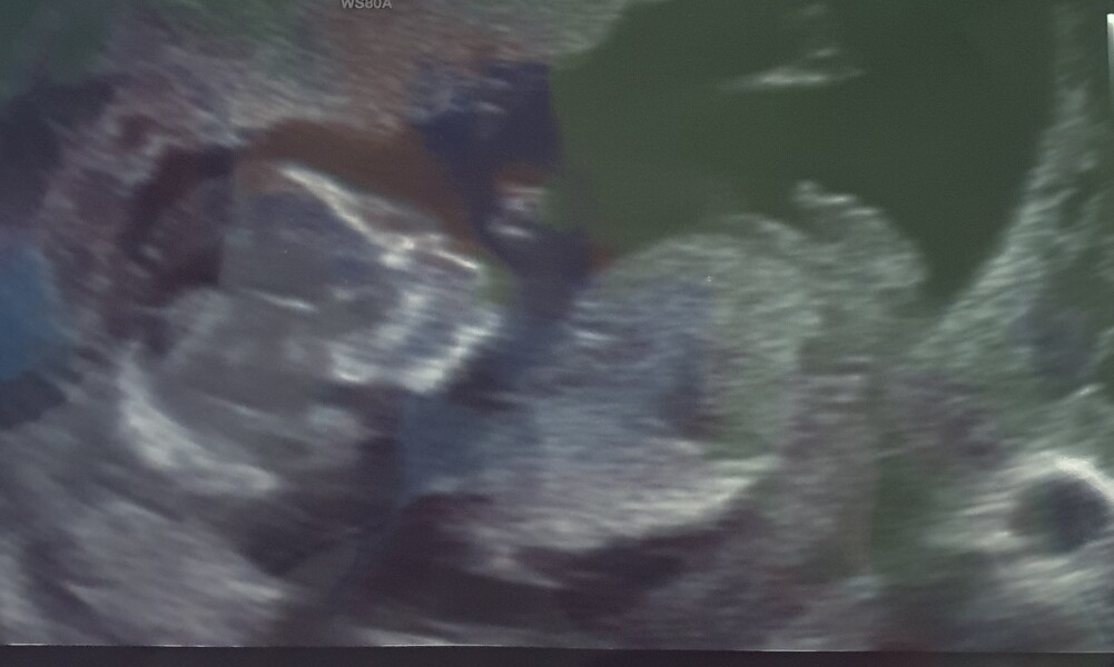 Baby January 2023!