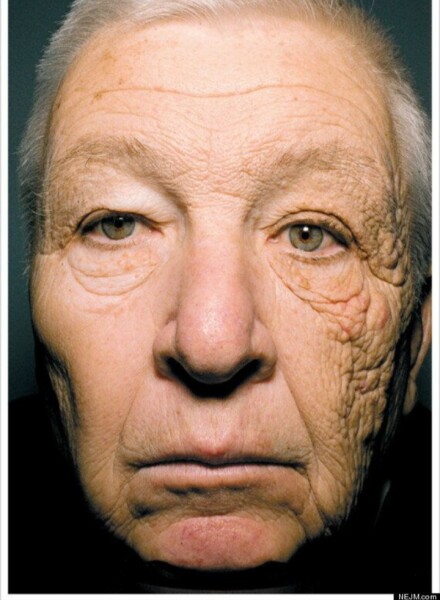 When did daily sunscreen become a mainstream thing?