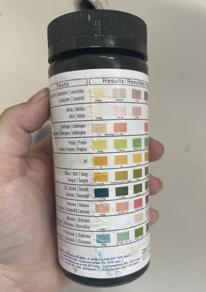 Anyone know about my dipstick test? 30 weeks pregnant. Protein 