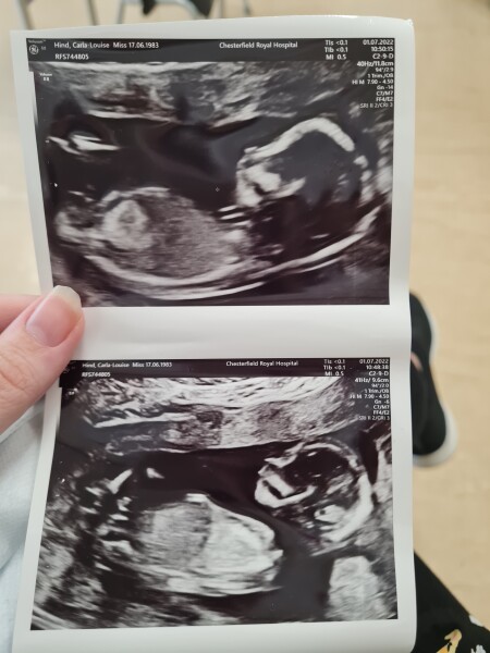 14 week scan boy or girl?
