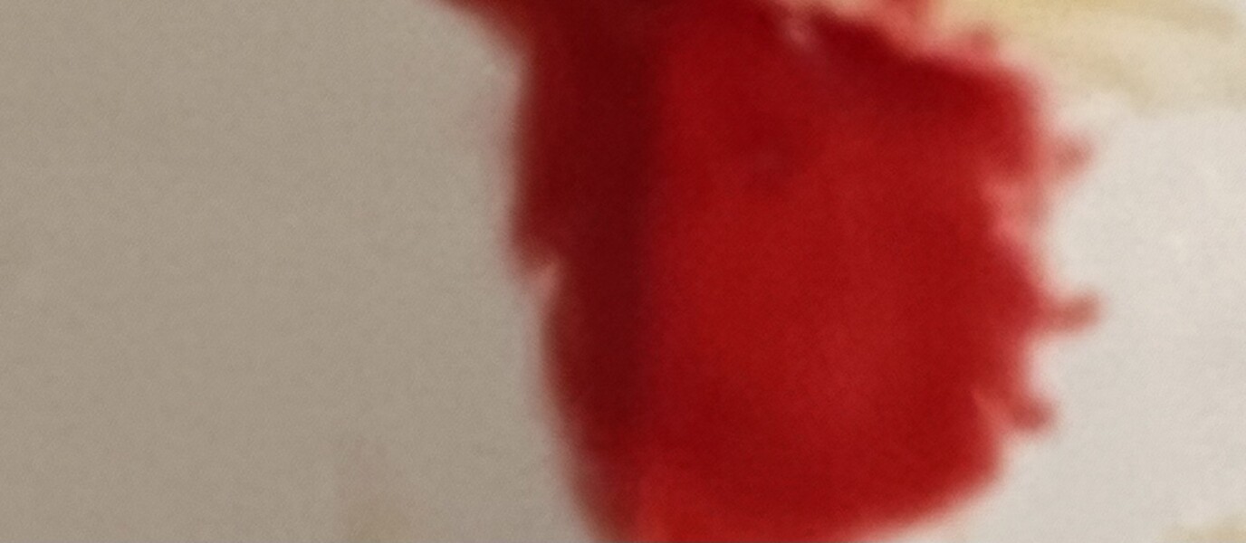 Bleeding again (17 weeks) tmi blood photo