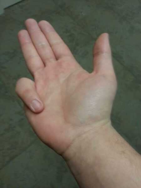 Using aibu because it's the only board with voting. Really MNHQ you should do something about that.  Anyway. Fingers. 