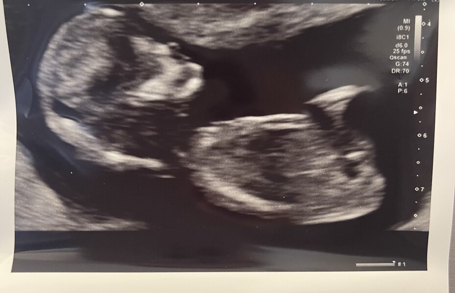 Gender guesses? 