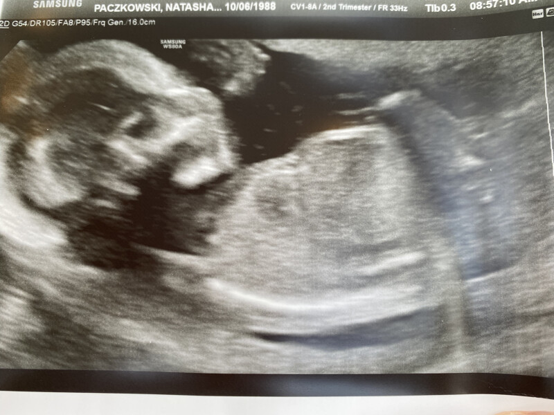 Due December 2022 (thread 4)