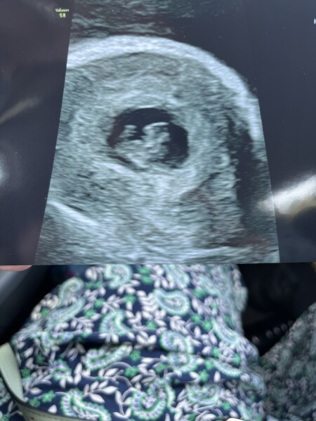 8 weeks on Monday and booked a scan