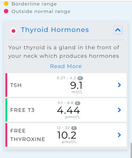Underactive thyroid??