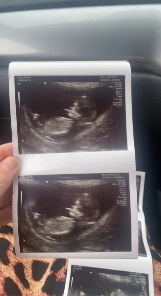 Boy or girl?