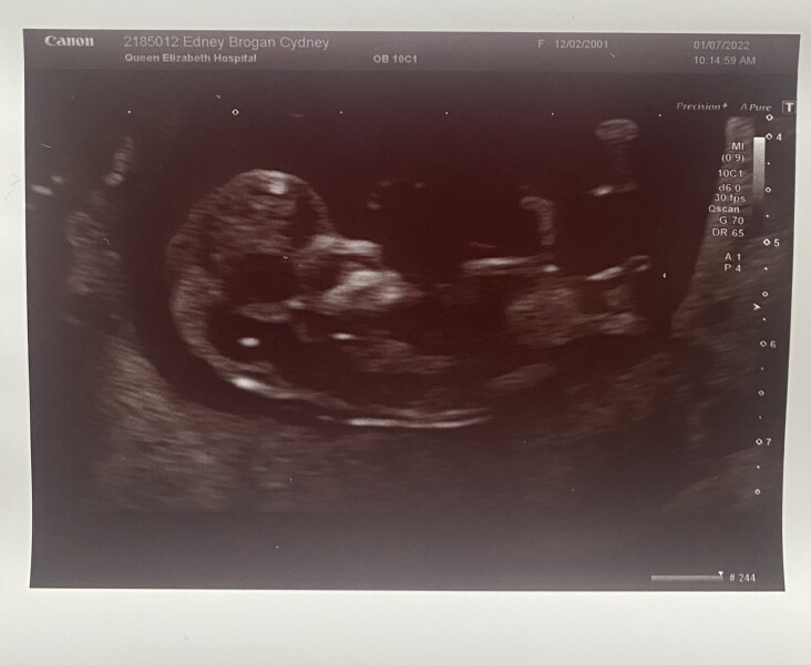 Pregnancy after miscarriage - thread 2