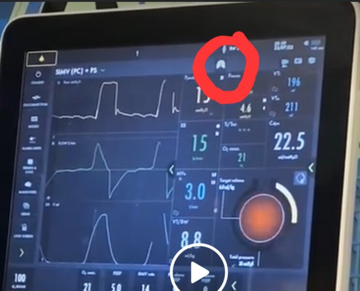 Archie Battersbee case