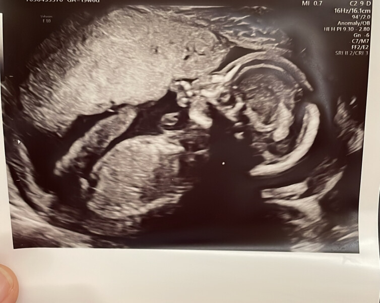 Navigating pregnancy after loss thread 3