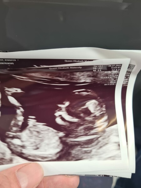 Due Jan 2023