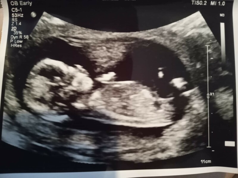 14 weeks girl or boy?
