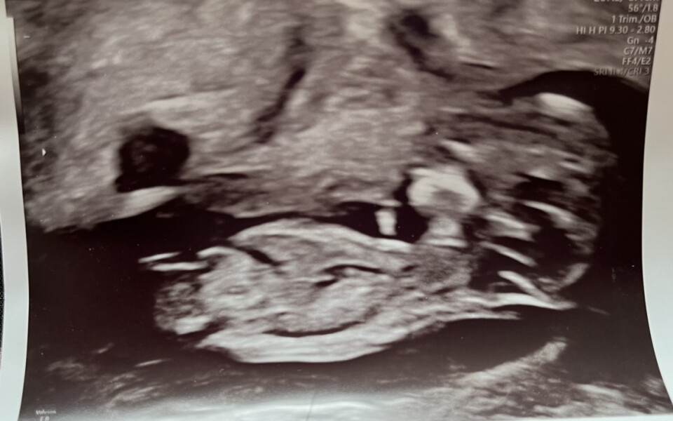 Due February 2023 ❤️💙💛💖 Thread 2!