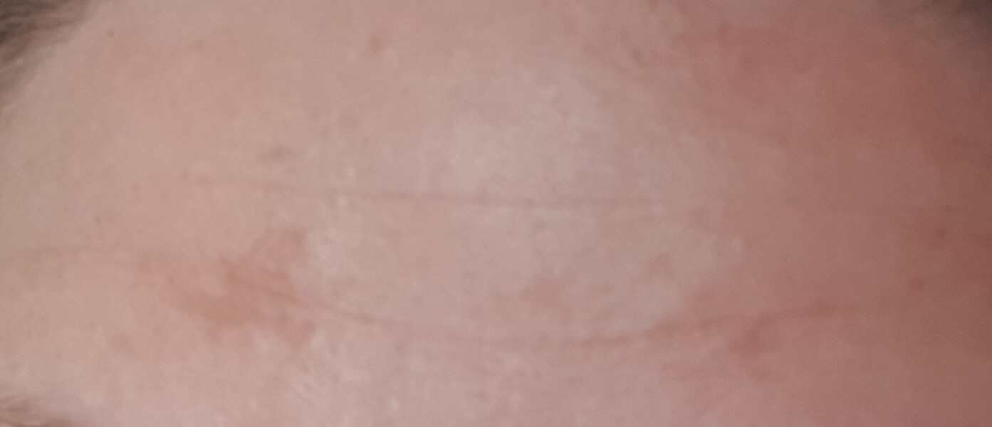 Suddenly looking old and panicking - help me!