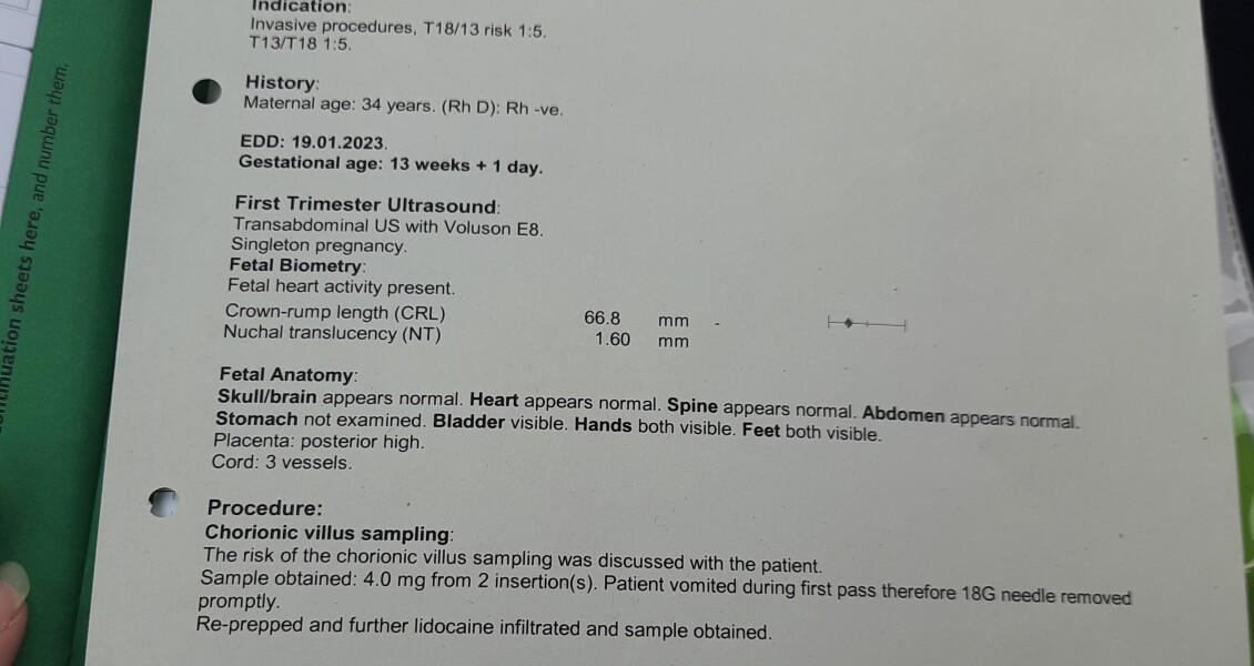 Cvs! Got 1 in 5 chance of E or P syndrome 