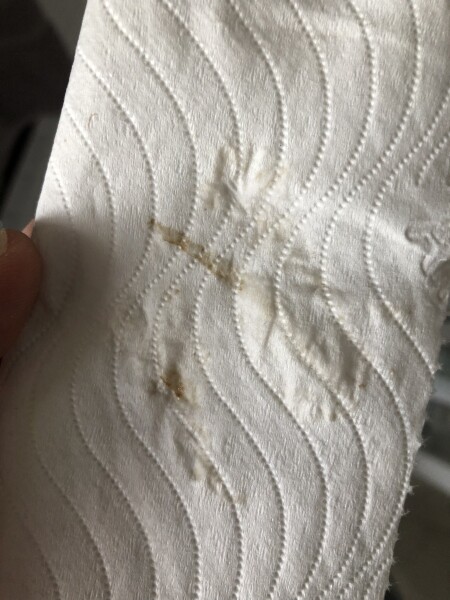 Am I having a chemical pregnancy? TMI but pic included 