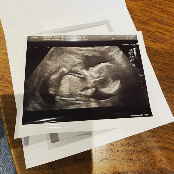 Boy or Girl?! What do you all think? 