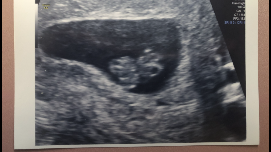 Preparing to TTC in 2022 part 4 -  where the BFPs keep on coming!