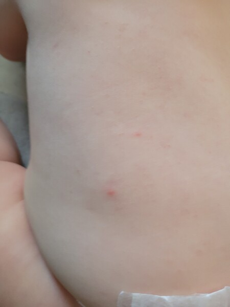 What's this on my baby?