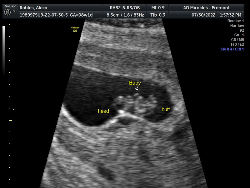 Due March 2023 ✨👶☀️🌈