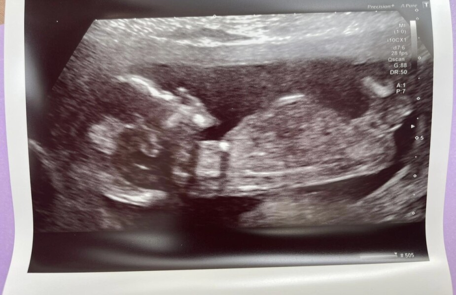 Gender guess anyone?