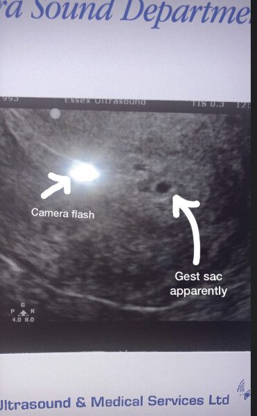 Any midwife’s on here? Ultrasound pic