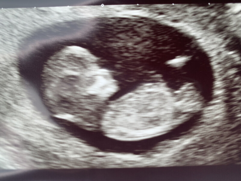 Baby January 2023!