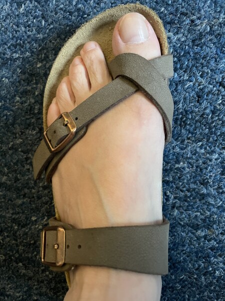 Advice on Birkenstocks
