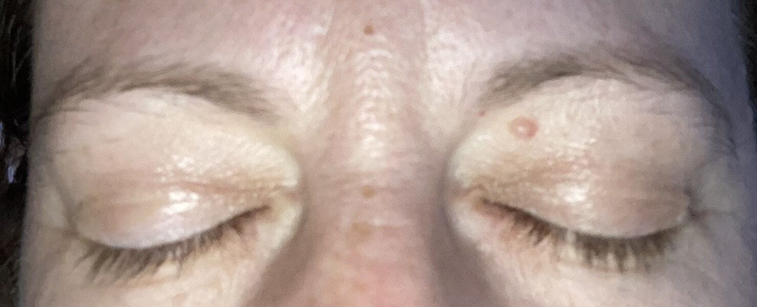 Eyebrow shape
