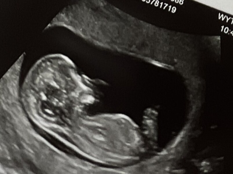 Due February 2023 ❤️💙💛💖 Thread 2!