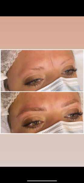 Tattooed eyebrows