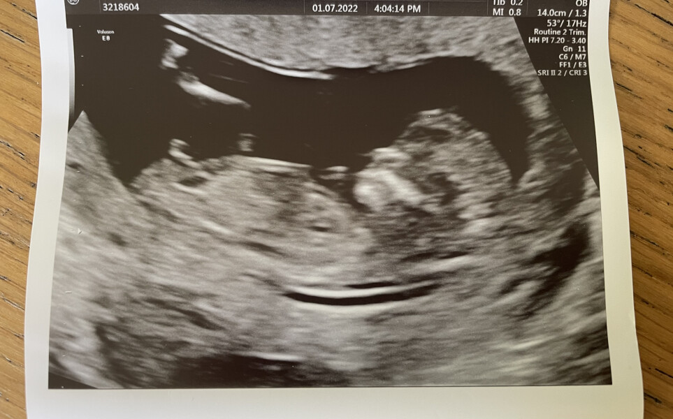 Due Jan 2023