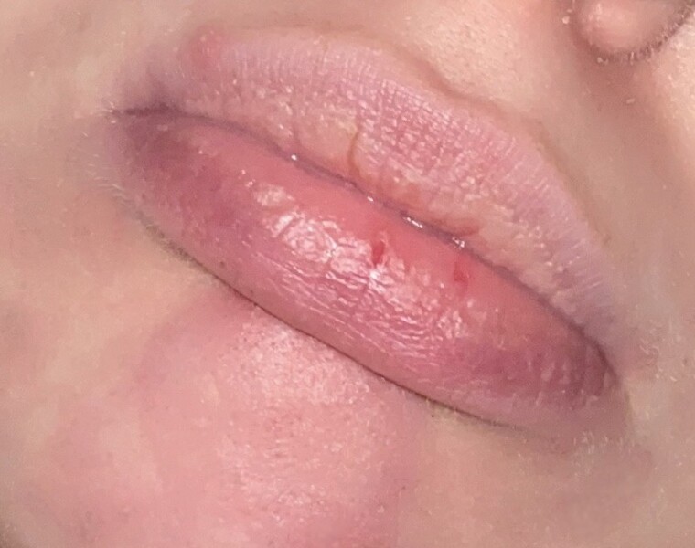 Do my lips look normal?