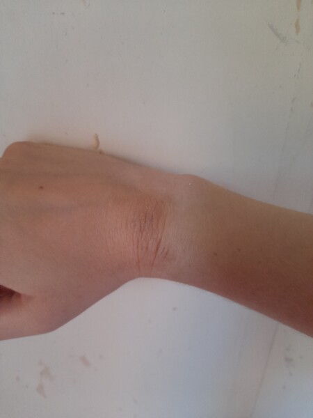 What's up with my skin?