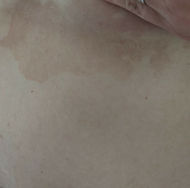 What is this on my skin!?