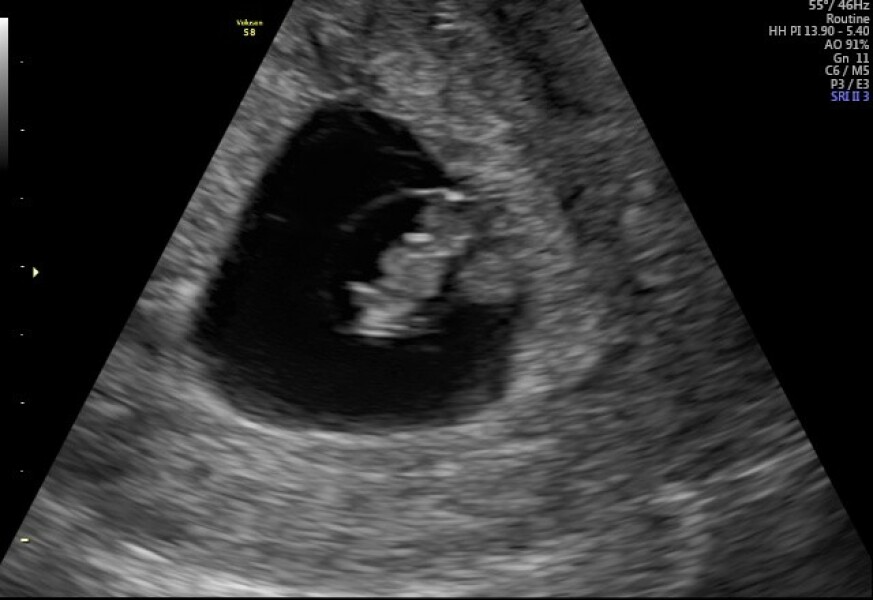 Due March 2023 ✨👶☀️🌈