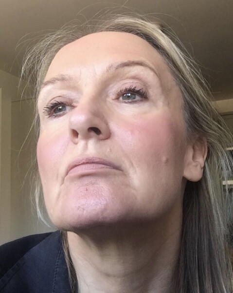 Sagging face and 45. What would you recommend? (Unflattering anonymised photo attached!)