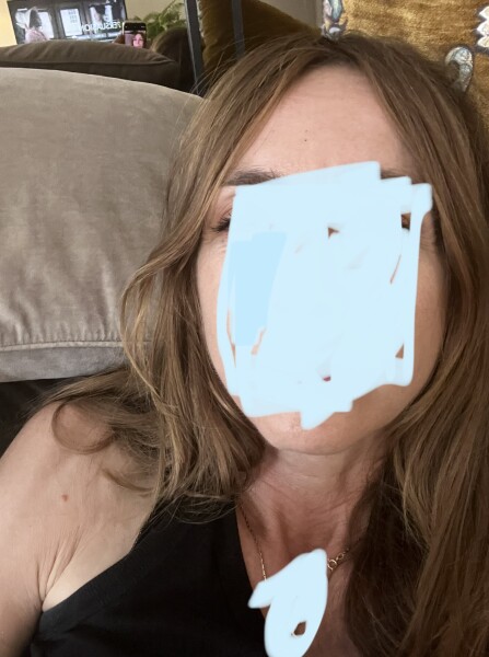 Receding hairline - to fringe or not to fringe 