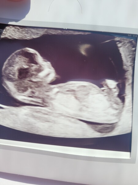 Baby January 2023!