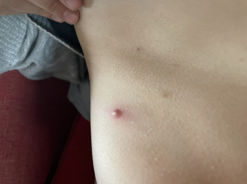 Repeated spots on stomach DS11