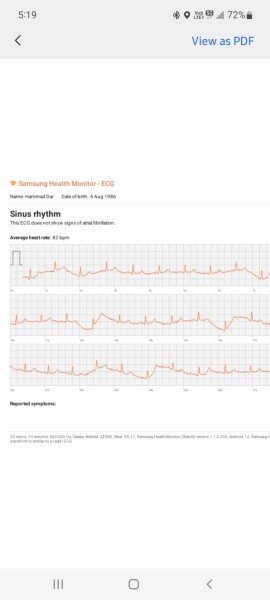 Ongoing centre chest pains, breathleness, upper back pain, been to A&E 3 times in 1 month 