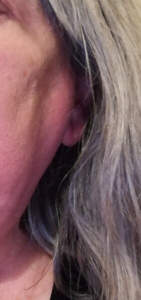 To be worried about skin discolouration, photo included
