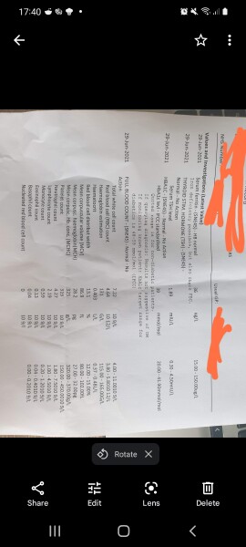 Anyone got quite significant hair loss (female)?