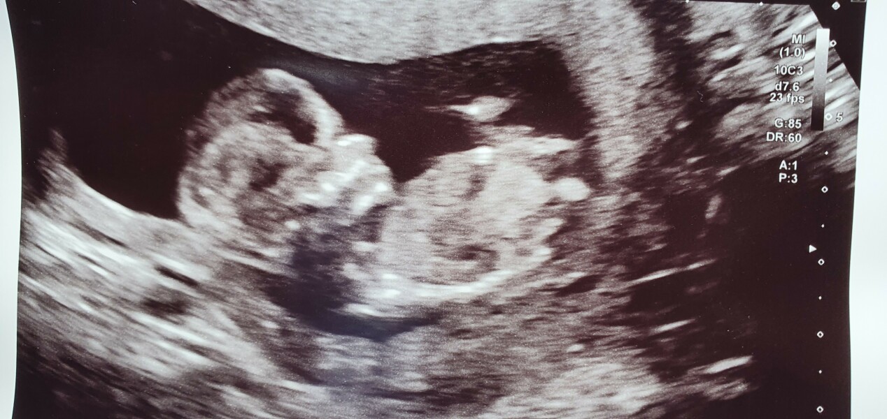 TTC immediately after miscarriage 