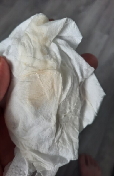 Tmi picture.  Start of blood or discharge.