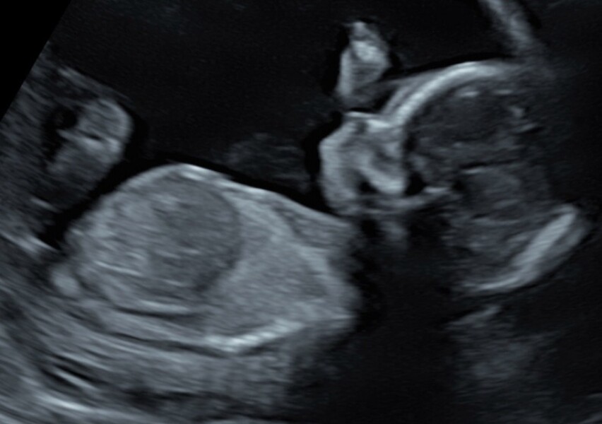 Due December 2022 (thread 4)