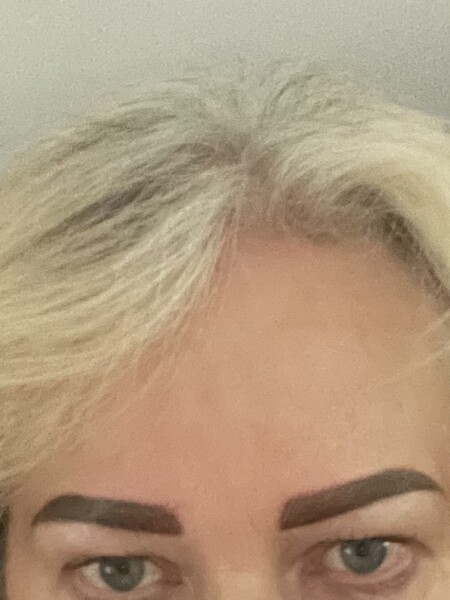 Microblading removal stories
