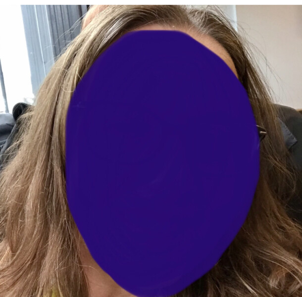 Managing greys in dark hair 