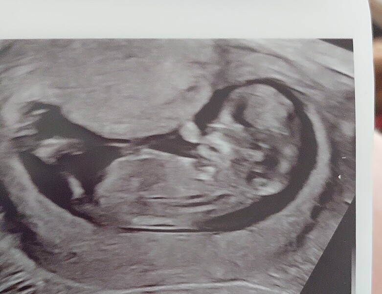 Boy or Girl predictions please 🙏 