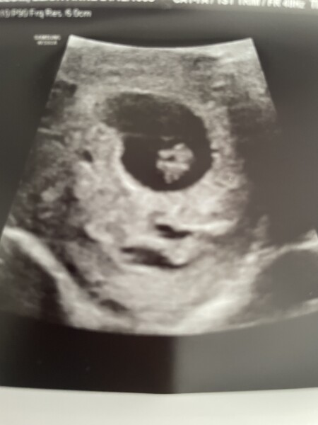 Due Feb/Mar after MC 🌈 🙈